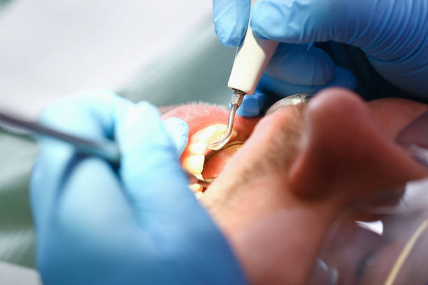 Best Emergency Root Canal Treatment in Bull Shoals, AR